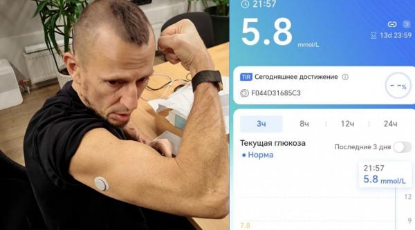 Ottai M8. Датчик непрерывного мониторинга глюкозы⁠⁠. Кто измеряет уровень глюкозы в крови? Чем пользуетесь? 