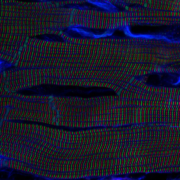 Сердце крысы и паук-скакун: в Японии выбрали 10 лучших научных микрофтографий года